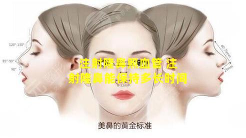 注射隆鼻照血管 注射隆鼻能保持多长时间
